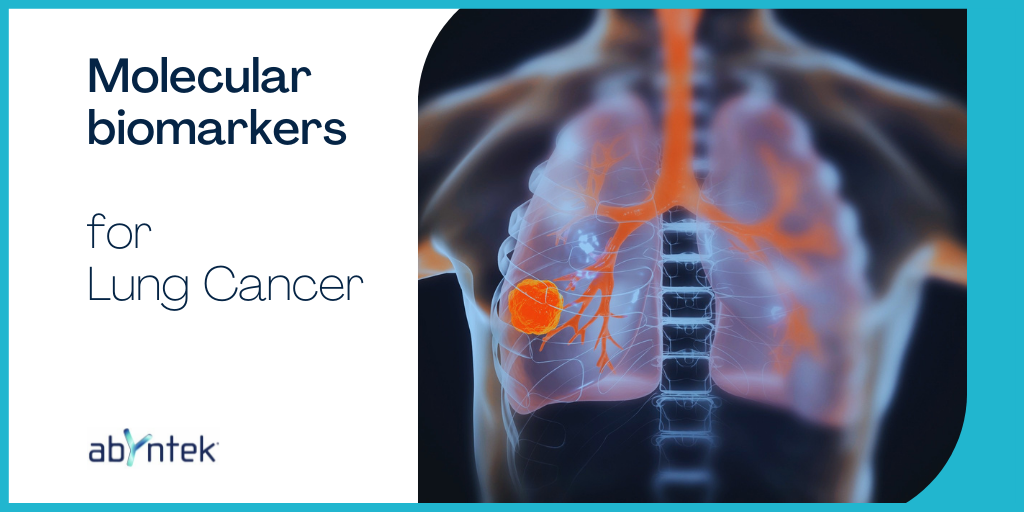 Molecular biomarkers for lung cancer